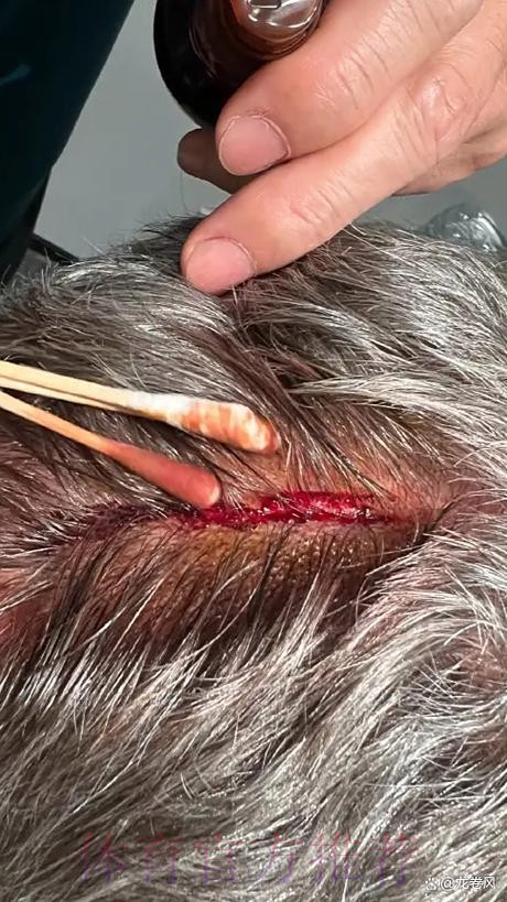 记者:安帅对纳乔红牌动作迷惑 两人均已向波图致歉